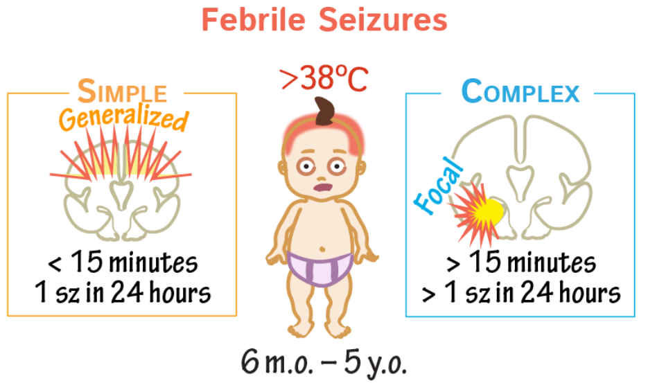 Ferbile Seizure